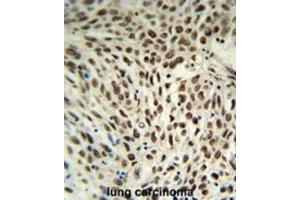 Immunohistochemistry (IHC) image for anti-Small Nuclear Ribonucleoprotein D3 Polypeptide 18kDa (SNRPD3) antibody (ABIN3004111)