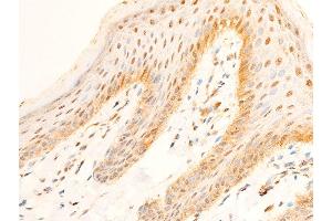 Immunohistochemistry (IHC) image for anti-Forkhead Box O3 (FOXO3) (pSer253) antibody (ABIN6255131)