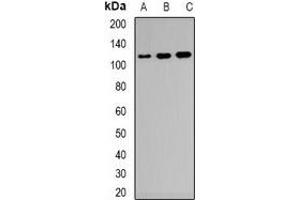 Western blot analysis of CD21 expression in Raji (A), KB (B), NIH3T3 (C) whole cell lysates. (CD21 antibody)