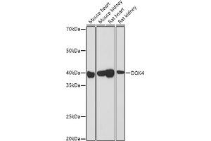 Western blot analysis of extracts of various cell lines, using DOK4 antibody (ABIN3020721, ABIN3020722, ABIN3020723 and ABIN6213691) at 1:1000 dilution.