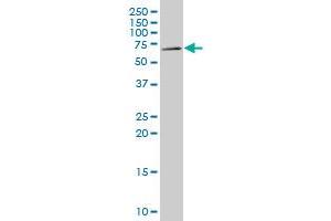 MFRP polyclonal antibody (A01), Lot # 051206JC01. (MFRP antibody  (AA 480-579))