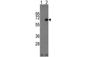Western blot analysis of AFP antibody and 293 cell lysate either nontransfected (Lane 1) or transiently transfected with the AFP gene (2). (alpha Fetoprotein antibody  (AA 300-329))