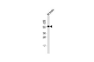 Anti-PRMT3 Antibody at 1:2000 dilution + mouse brain lysates Lysates/proteins at 20 μg per lane. (PRMT3 antibody  (N-Term))