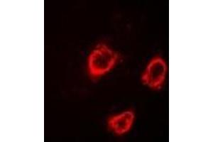 Immunofluorescent analysis of TRPV5 staining in HT29 cells. (TRPV5 antibody)