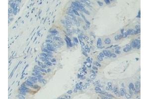 Immunohistochemistry (IHC) image for anti-Basal Cell Adhesion Molecule (Lutheran Blood Group) (BCAM) (AA 32-257) antibody (ABIN7442009)