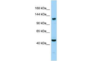 Host: Rabbit Target Name: Agtpbp1 Sample Type: Mouse Testis lysates Antibody Dilution: 1. (AGTPBP1 antibody  (C-Term))