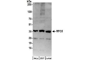 Western Blotting (WB) image for anti-Replication Factor C (Activator 1) 5, 36.5kDa (RFC5) (AA 1-50) antibody (ABIN7449278)
