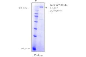 SDS-Page of purified SPIKE from B. (SARS-CoV-2 Spike Protein (B.1.617.1 - kappa) (rho-1D4 tag))