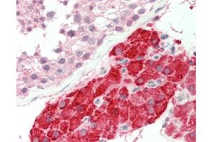 Immunohistochemistry (IHC) image for anti-Nuclear Receptor Subfamily 2, Group E, Member 1 (NR2E1) (AA 144-193) antibody (ABIN6755437)