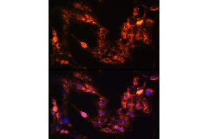 Immunofluorescence analysis of C6 cells using GRM1 Rabbit pAb  at dilution of 1:100 (40x lens).