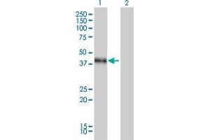 Western Blot analysis of DLX3 expression in transfected 293T cell line by DLX3 monoclonal antibody (M01), clone 4F8. (DLX3 antibody  (AA 1-287))