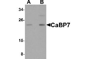 Western Blotting (WB) image for anti-Calcium Binding Protein 7 (CABP7) (N-Term) antibody (ABIN1031287) (CABP7 antibody  (N-Term))
