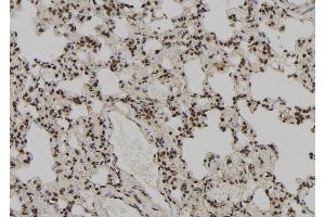 ABIN6272384 at 1/100 staining Rat lung tissue by IHC-P. (PEG3 antibody)