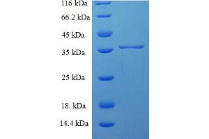 SDS-PAGE (SDS) image for Sorting Nexin 24 (SNX24) (AA 1-169), (full length) protein (His-SUMO Tag) (ABIN5710394) (SNX24 Protein (AA 1-169, full length) (His-SUMO Tag))