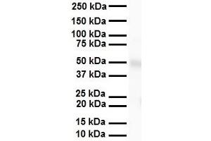 WB Suggested Anti-SIL1 antibody Titration: 1 ug/mL Sample Type: Human heart (SIL1 antibody  (C-Term))