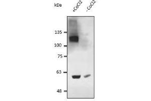 Western Blotting (WB) image for anti-Hypoxia Inducible Factor 1, alpha Subunit (Basic Helix-Loop-Helix Transcription Factor) (HIF1A) (AA 470-590) antibody (ABIN6254228)