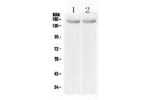 Western blot analysis of MED14 using anti-MED14 antibody .