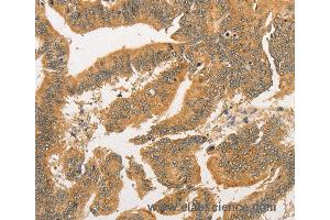Immunohistochemistry of Human tonsil using BCL2L14 Polyclonal Antibody at dilution of 1:40 (BCL2L14 antibody)