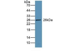 Detection of Recombinant RBP3, Rat using Polyclonal Antibody to Retinol Binding Protein 3, Interstitial (RBP3) (RBP3 antibody  (AA 1027-1229))