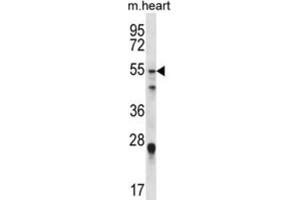 Western Blotting (WB) image for anti-Forkhead Box O6 (Foxo6) antibody (ABIN2996675)