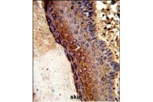 Immunohistochemistry (Paraffin-embedded Sections) (IHC (p)) image for anti-UDP-Galactose-4-Epimerase (GALE) (AA 142-171) antibody (ABIN390889)
