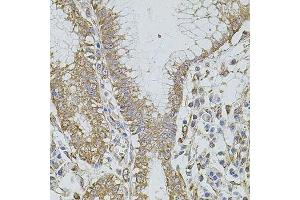 Immunohistochemistry of paraffin-embedded human stomach using HMMR antibody.