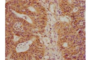 anti-Zinc Finger, BED-Type Containing 3 (ZBED3) (AA 1-234) antibody