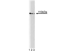 Western blot analysis of PI3-Kinase p110alpha on Jurkat lysate. (PIK3CA antibody  (AA 101-300))