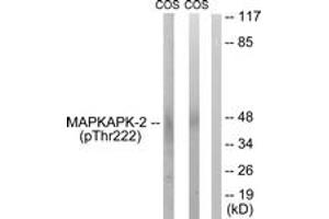 Western blot analysis of extracts from COS7 cells treated with UV 15', using MAPKAPK-2 (Phospho-Thr222) Antibody. (MAPKAP Kinase 2 antibody  (pThr222))