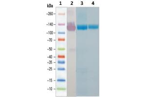 Western Blotting (WB) image for SARS-CoV-2 Spike protein (His tag) (ABIN6964448)