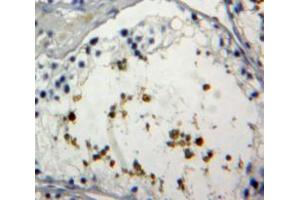 IHC-P analysis of Testis tissue, with DAB staining. (FOXP1 antibody  (AA 461-671))