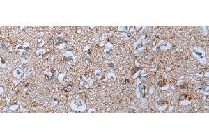 Immunohistochemistry of paraffin-embedded Human brain tissue using YPEL5 Polyclonal Antibody at dilution of 1:60(x200) (YPEL5 antibody)