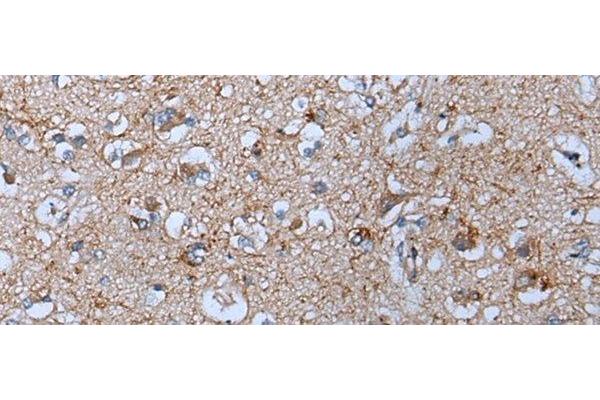 YPEL5 antibody