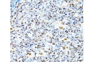 Immunohistochemistry of paraffin-embedded Human appendix using XRCC4 Polyclonal Antibody at dilution of 1:100 (40x lens). (XRCC4 antibody)