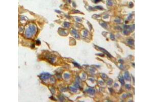 IHC-P analysis of ovary tissue, with DAB staining.