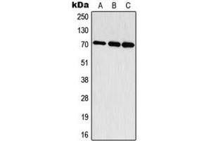 Western blot analysis of S6K1 (pT444) expression in HepG2 EGF-treated (A), mouse brain (B), rat brain (C) whole cell lysates.