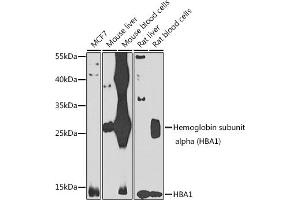 Western blot analysis of extracts of various cell lines, using Hemoglobin subunit alpha (Hemoglobin subunit alpha (HB)) antibody (ABIN6128046, ABIN6141635, ABIN6141636 and ABIN6223164) at 1:1000 dilution.