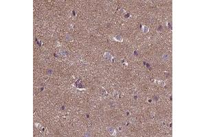 ABIN6266756 at 1/100 staining human brain tissue sections by IHC-P. (ANKRD26 antibody  (Internal Region))