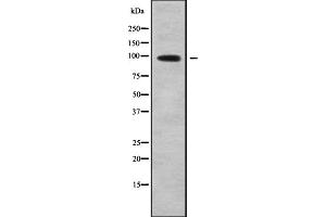 Western blot analysis of ATP6V0A2 using COLO205 whole cell lysates
