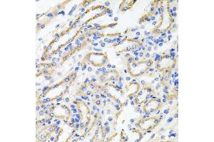 Immunohistochemistry of paraffin-embedded mouse kidney using IRAK2 antibody. (IRAK2 antibody)