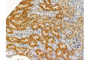 ABIN7096825 and ABIN7100891 at 1/100 staining mouse kidney tissue by IHC-P. (CRISP1 antibody)