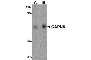 Western blot analysis of CAPN6 in rat lung tissue lysate with AP30177PU-N CAPN6 antibody at (A) 0. (Calpain 6 antibody  (C-Term))