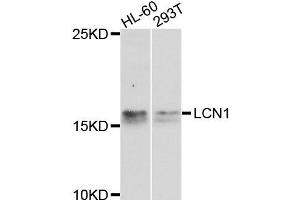 Western blot analysis of extracts of HL60 and 293T cells, using LCN1 antibody. (Lipocalin 1 antibody)