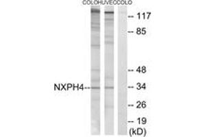Western blot analysis of extracts from COLO/HuvEc cells, using NXPH4 Antibody.