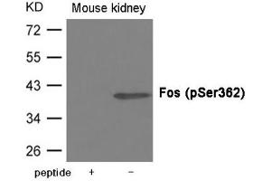 Western blot analysis of extracts from Mouse kidney tissue using Fos (Phospho-Ser362) Antibody. (c-FOS antibody  (pSer362))
