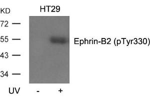 Western blot analysis of extracts from HT29 cells, untreated or treated with UV using Ephrin-B2(Phospho-Tyr330) Antibody.