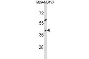 Western Blotting (WB) image for anti-Olfactory Receptor, Family 10, Subfamily G, Member 8 (OR10G8) antibody (ABIN3000509)