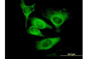 Immunofluorescence of monoclonal antibody to EIF5 on HeLa cell. (EIF5 antibody  (AA 1-431))