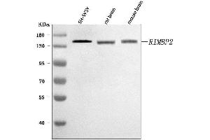 Western blot analysis of RIMBP2 using anti-RIMBP2 antibody (ABIN7601441). (RIMBP2 antibody  (AA 351-1049))