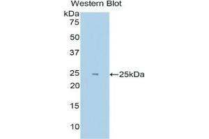 Detection of Recombinant HIF2a, Human using Polyclonal Antibody to Hypoxia Inducible Factor 2 Alpha (HIF2a) (EPAS1 antibody  (AA 339-541))